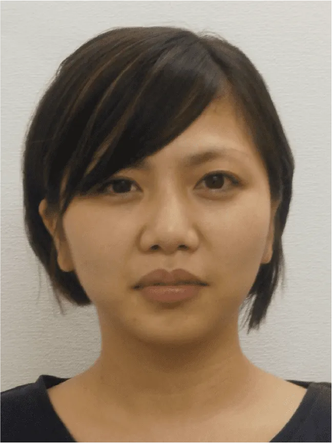 小顔矯正のビフォーアフター