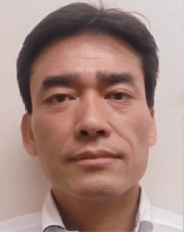 小顔矯正のビフォーアフター